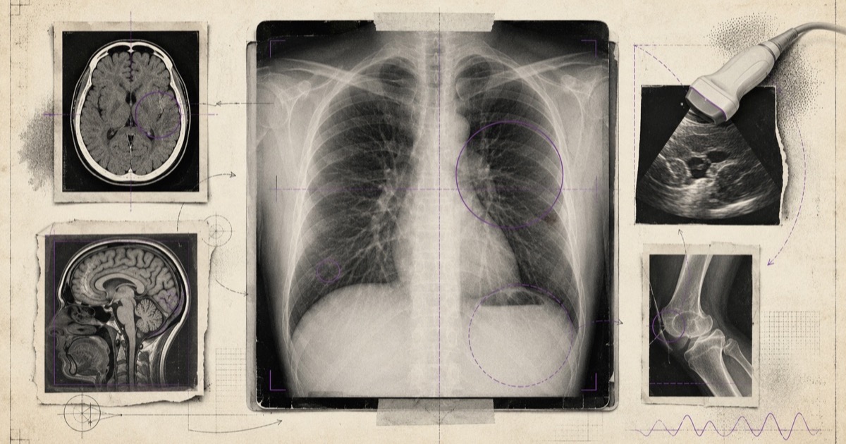 Pencil illustration of a chest X-ray on a viewing box with an area circled, flanked by CT and MRI images of the brain, an ultrasound probe in use and a knee X-ray